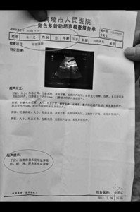 男子体检报告称“子宫”正常 医师登门致歉