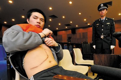 中国人体器官交易黑市猖獗 供体被当牲口豢养