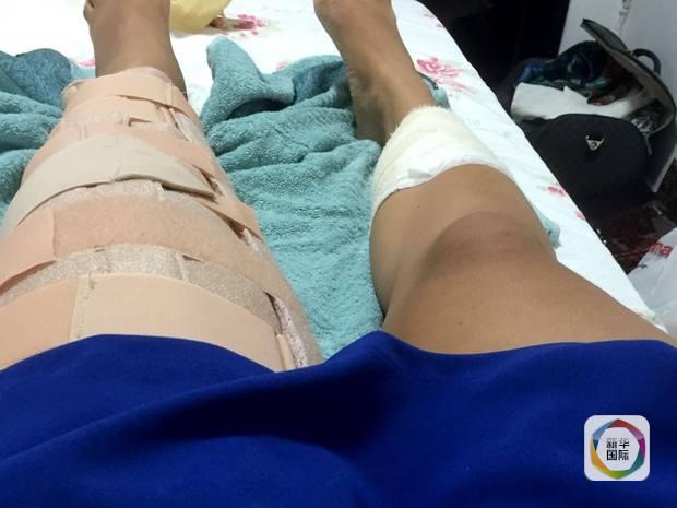 巴西女子遭歹徒枪击 隆胸硅胶挡住致命一枪(图)