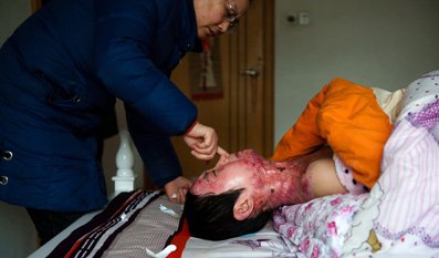 合肥少女被男同学泼燃油而焚毁的花季