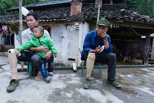 中越边境的“地雷村”：同村父子母子被炸断腿