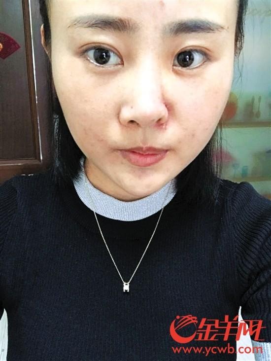 丽江遭暴打女子刑事附带民事提诉获立案