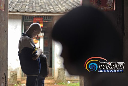 海口13岁<em>女孩头发突然掉</em>光 无力承担高额检查