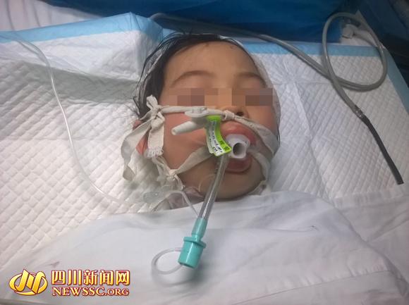 四川10岁女孩被养母砍成重伤 目前已脱离生命危险