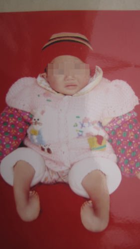 孕妇12次产检生下畸形儿 医院称没过错不担责