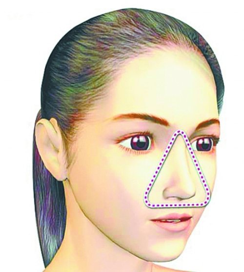 湖北11岁女孩挤青春痘引发重度骨髓炎危及生