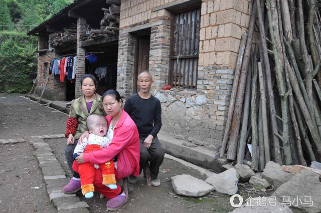 小孩似外星人无钱治 妈妈注射器抽积液