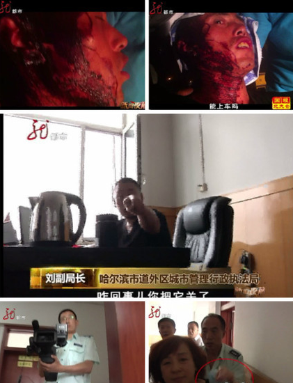 哈尔滨商贩被城管打至头破血流 记者采访被打
