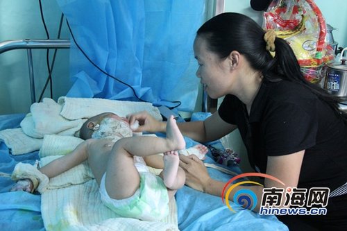 口八个月男童烫伤住院 南海网设立爱心基金救