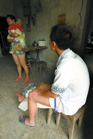 丈夫车祸后坦白隐瞒艾滋病结婚 妻子仍不离不弃