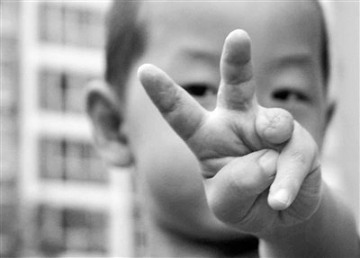 男童被电梯夹断3根手指再植2根 家长索赔