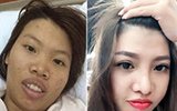 越南女孩相亲被嫌“看着吃不下饭”，花9万整容后闪嫁富二代