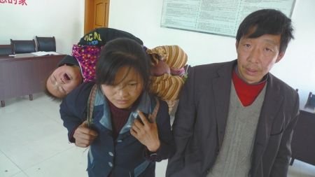 4岁男孩患肿瘤睾丸肿大如皮球(图)