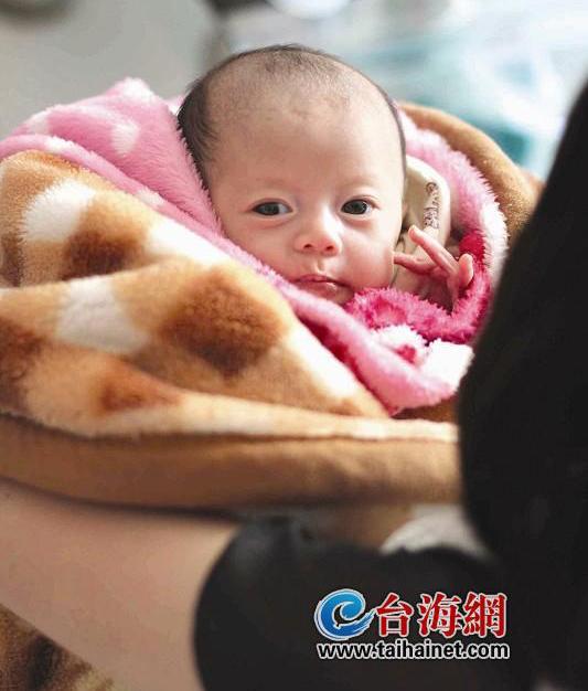 高中生诞下双胞胎女儿 患先天性巨结肠亟待救命 高中生诞下双胞胎女儿 患先天性巨结肠亟待救命