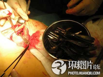 全球五花八门的异食癖