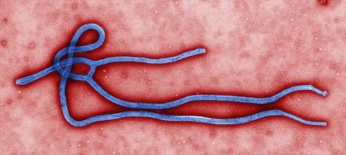 早期类似感冒 晚期出血不止:感染埃博拉病毒后