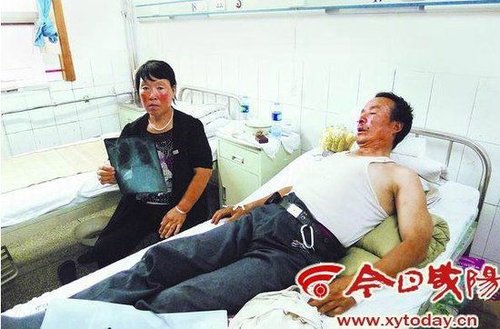 城管当着副镇长面围殴民工 致其骨折昏厥(图)