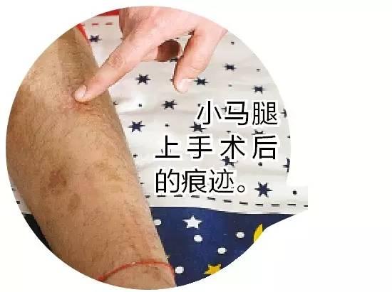 黑龙江一中学女书记在校内开车 轧折学生腿4