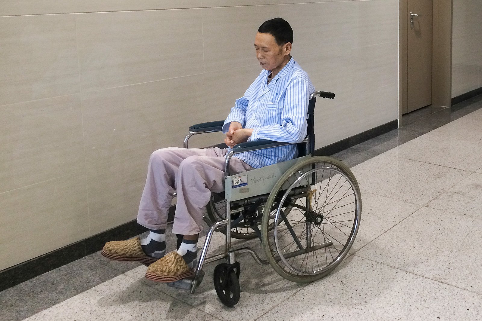 这是放疗十次后的父亲,人已经成了皮包骨,脸上惨白没有一丝血色,下床活动要人抱着,出去散步也要用轮椅。父亲的爱好搁浅了,他已再也没有多余的力气。 这是放疗十次后的父亲,人已经成了皮包骨,脸上惨白没有一丝血色,下床活动要人抱着,出去散步也要用轮椅。父亲的爱好搁浅了,他已再也没有多余的力气。