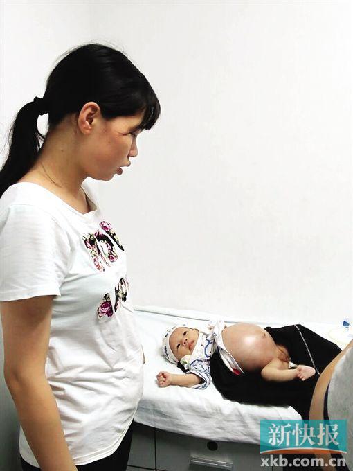 满月女婴患巨结肠症肚大如球 百人跨省救援(图)_新闻 ...