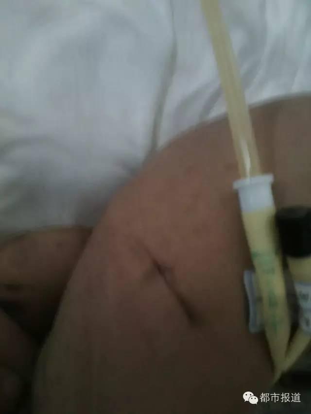 只因偷情时哭闹，洛阳2岁女童遭妈妈情夫捆绑虐打 生命垂危&hellip;&hellip;