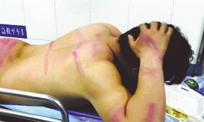 After hitting, discard