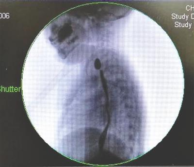 3��Ů��������Ŧ�۵�� ����ʳ����Ż3����