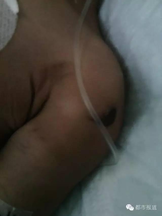 只因偷情时哭闹，洛阳2岁女童遭妈妈情夫捆绑虐打 生命垂危&hellip;&hellip;