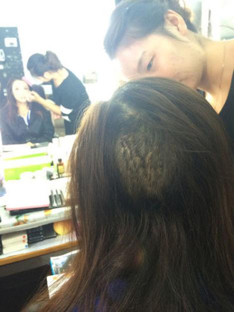 组图：叶璇宠物狗咬伤女星李依晓头部 致其缝20多针