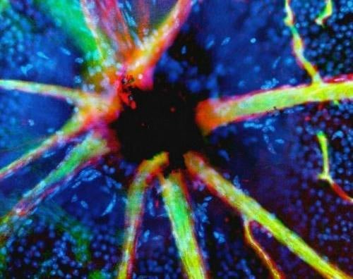 图组:难得一见的人体图片 <em>头发分叉</em>到底<em>啥样</em>_