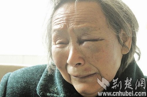 图为：说起不孝子，左眼肿得难以睁开的明老太伤心不已