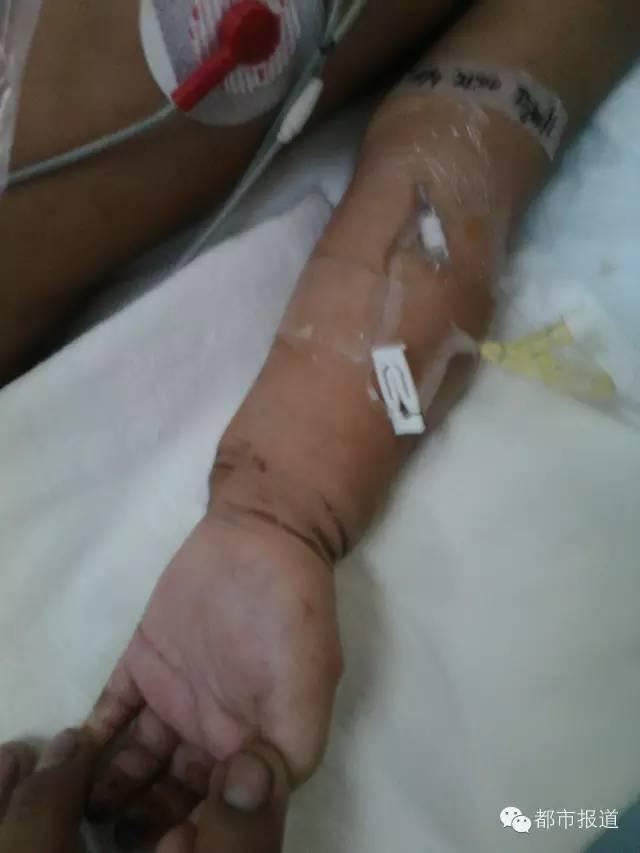 只因偷情时哭闹，洛阳2岁女童遭妈妈情夫捆绑虐打 生命垂危&hellip;&hellip;