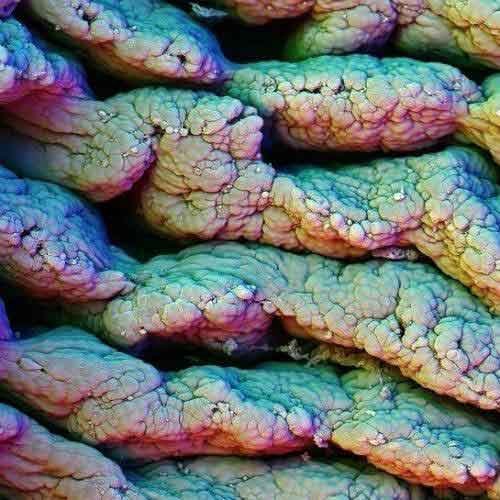 图组:难得一见的人体图片 <em>头发分叉</em>到底<em>啥样</em>_