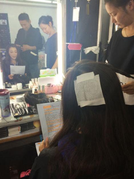 组图：叶璇宠物狗咬伤女星李依晓头部 致其缝20多针