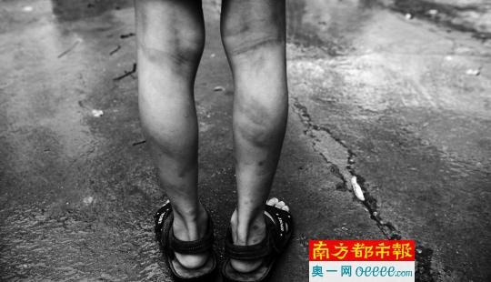 小学生不愿“补课”遭班主任暴打 全家被骂没文化