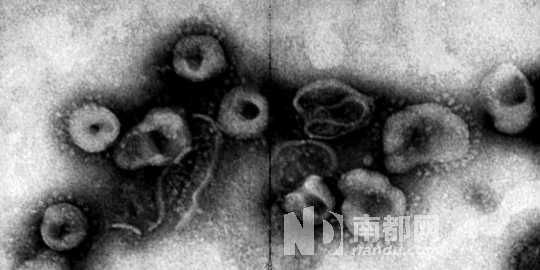 非典一线医生：保密制度在疫情面前很可能要命