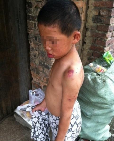 仙游县榜头镇南溪村9岁男孩小龙遭母亲虐待被剪耳朵划脸 图