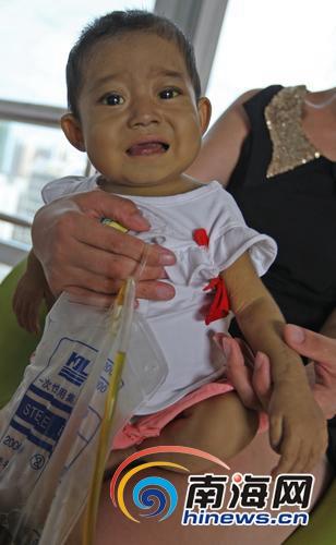 海口女婴患怪病腹大如鼓 肝移植才能救命