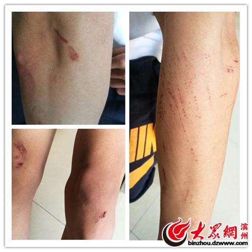 山东滨州学院,被女朋友抱了一下的男大学生遭遇殴打,图片来自大众网 山东滨州学院,被女朋友抱了一下的男大学生遭遇殴打,图片来自大众网