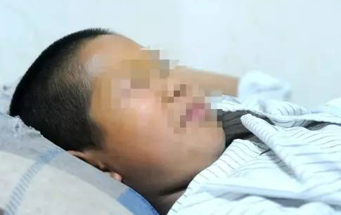 新疆一10岁男孩眼睛被同学的牙签弩射伤