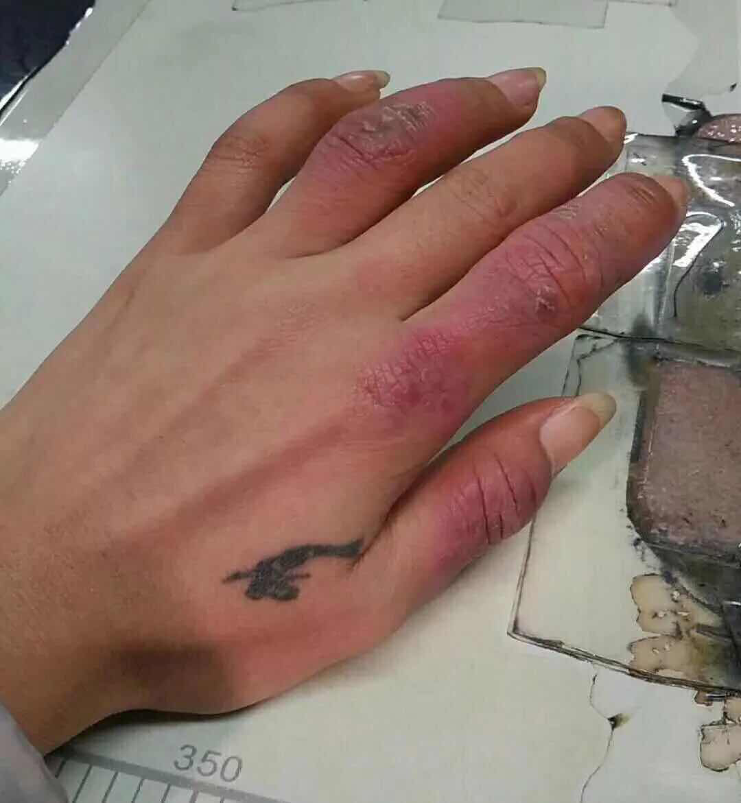 满是冻疮还得挥舞剪刀的手