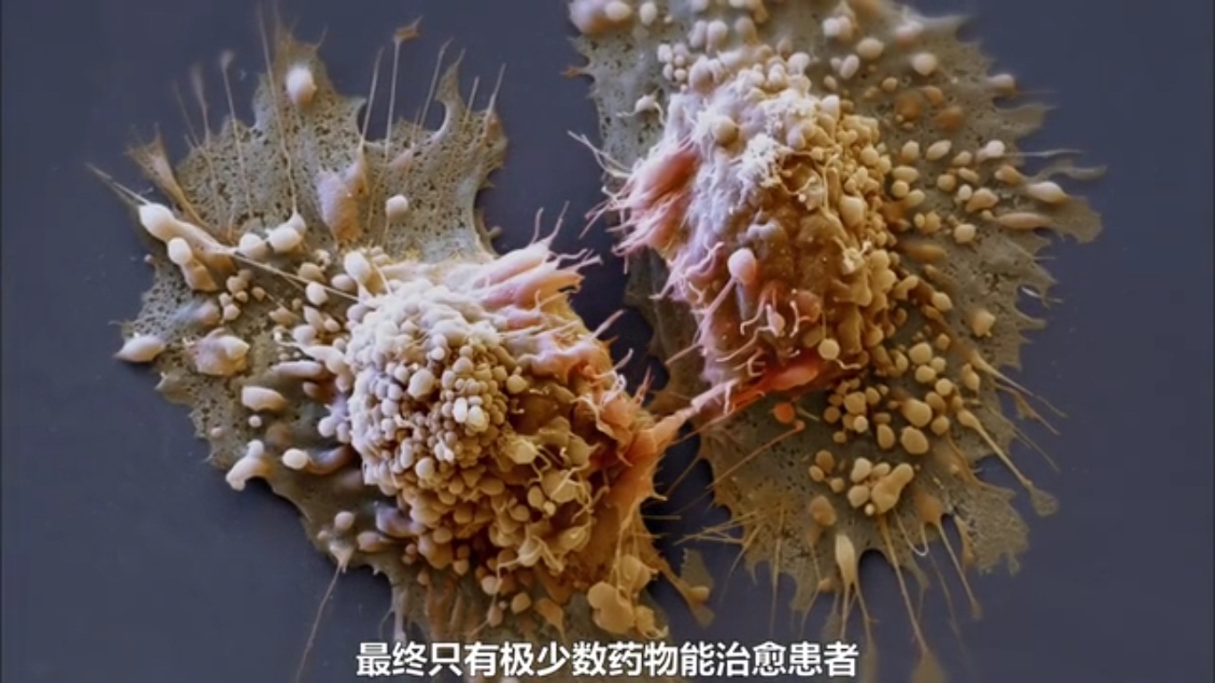 癌细胞正在分裂中。《癌症:众疾之王》剧照 癌细胞正在分裂中。《癌症:众疾之王》剧照