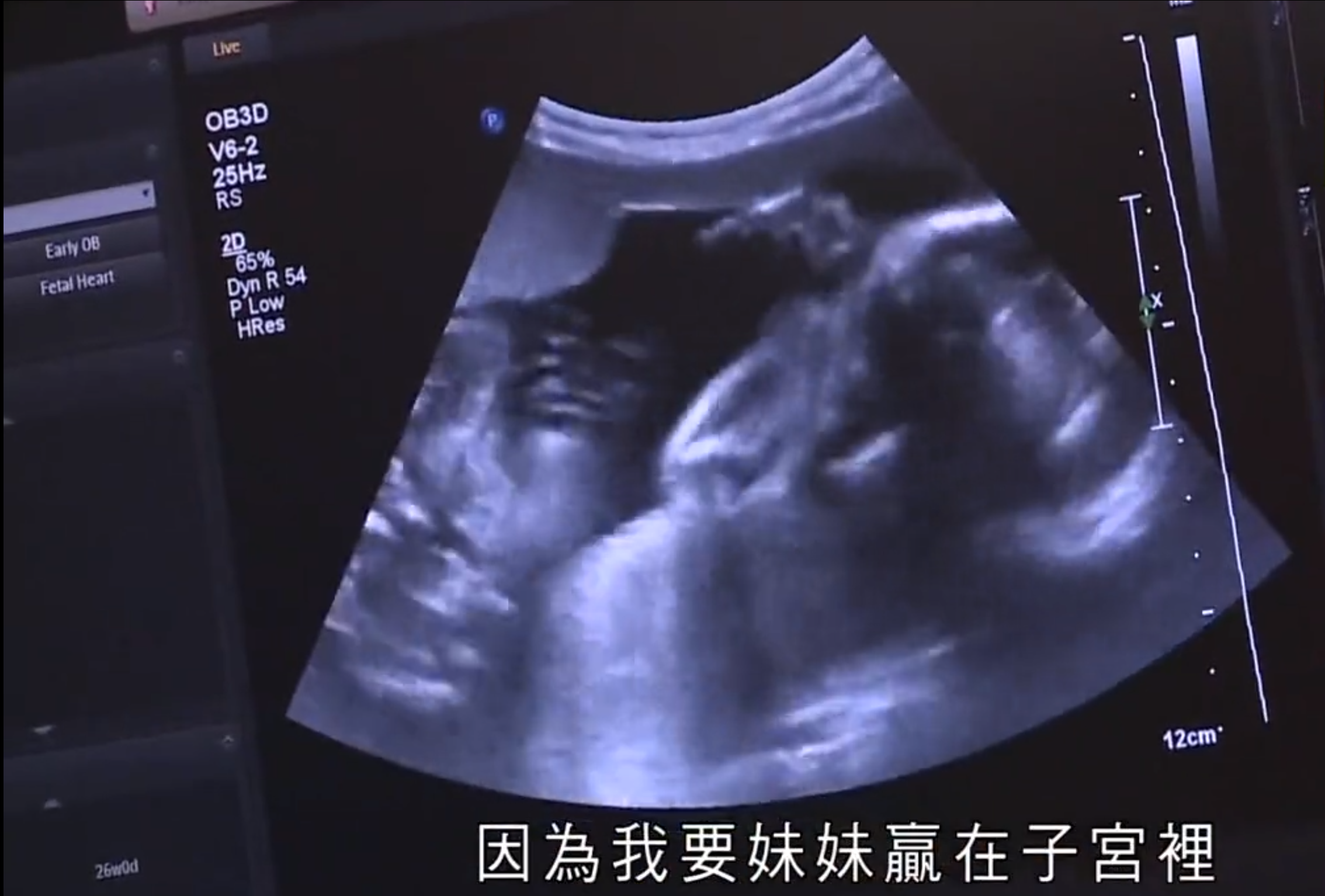 《没有起跑线》的剧照 《没有起跑线》的剧照