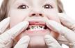 孩子为什么会长蛀牙?