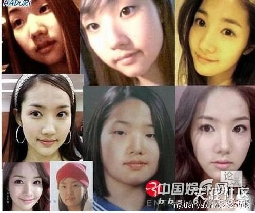 <em>城市猎人女主角</em>整容前后对比照 - 女性资讯 | 拍