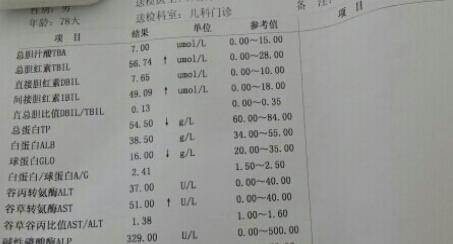 教你怎样看懂血常规化验单