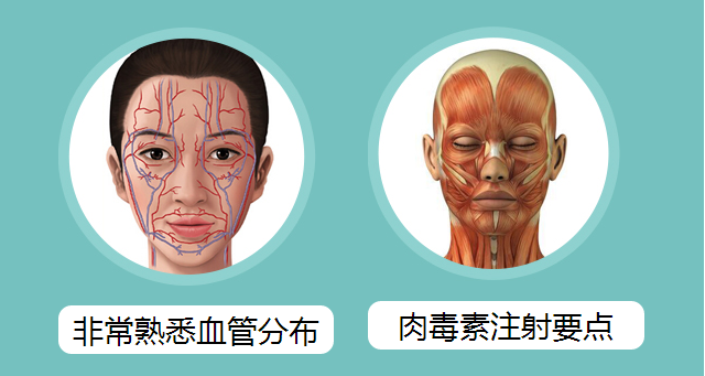 上海华美聂婕主任解答瘦脸针的副作用有哪些