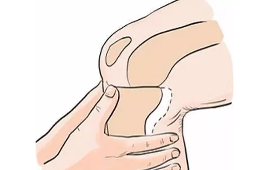 生命在于运动还是静止?--关注骨关节炎