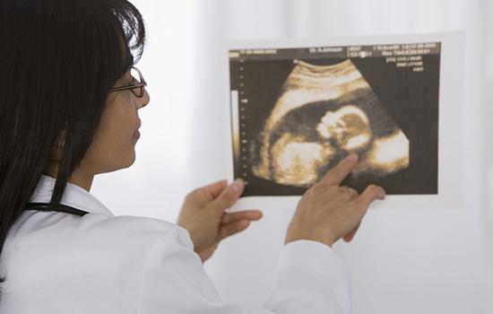 孕中期B超主要检查什么?