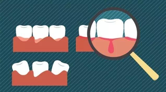 你问我答之鼻子和牙龈出血